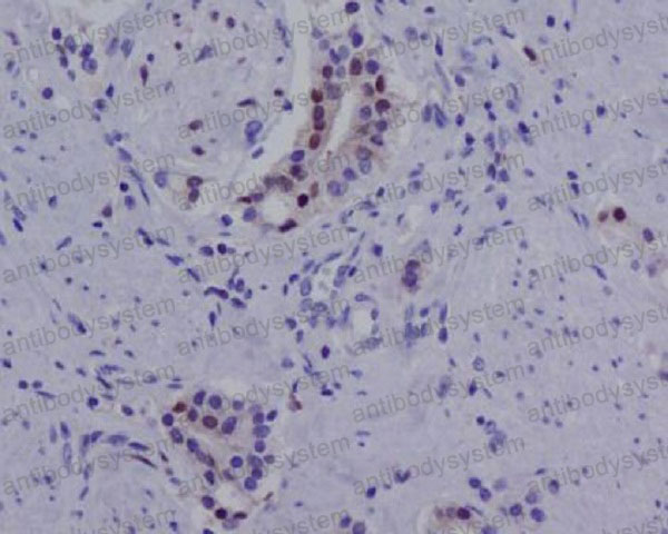 Anti-AR Antibody (R1C28)