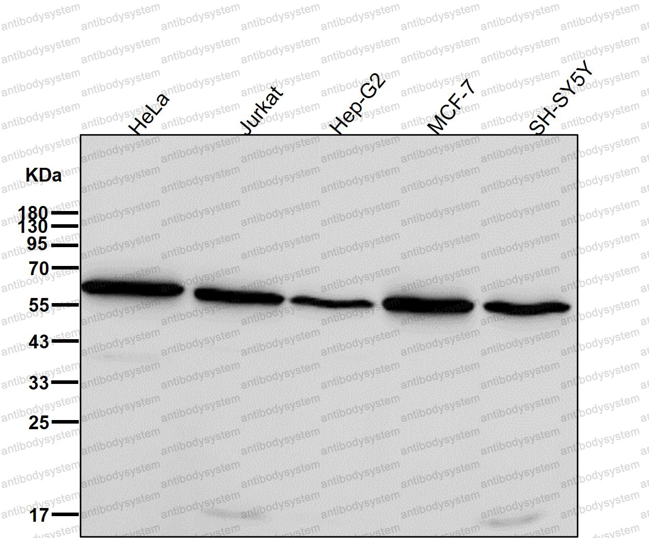 Anti-RARA Antibody (R1M61)