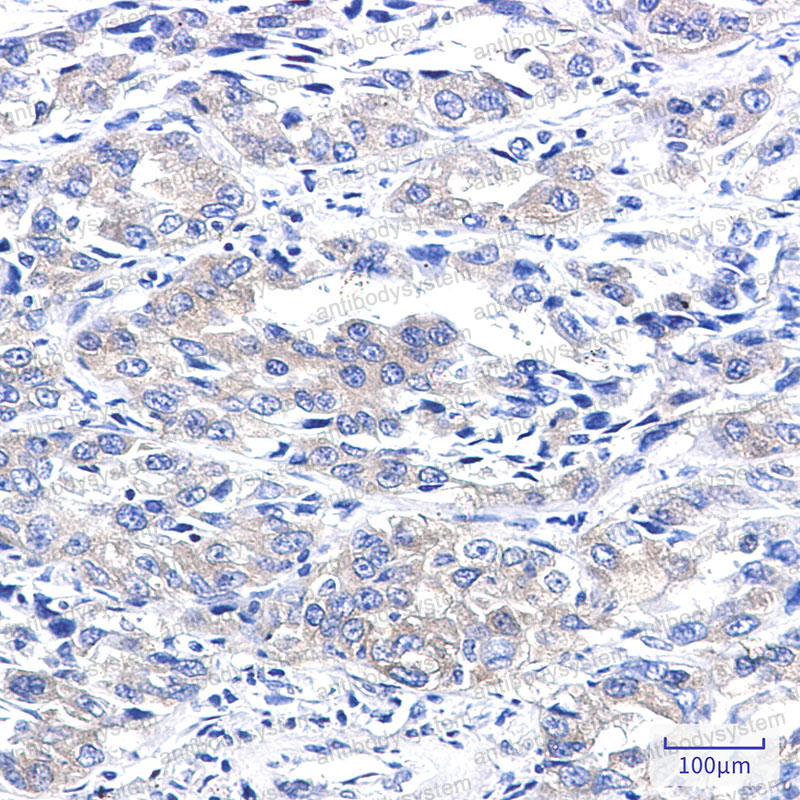Anti-ARAF Antibody (R1M64)