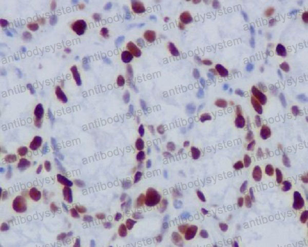 Anti-Phospho-Histone H1.4 (T17) Antibody (R1C22)