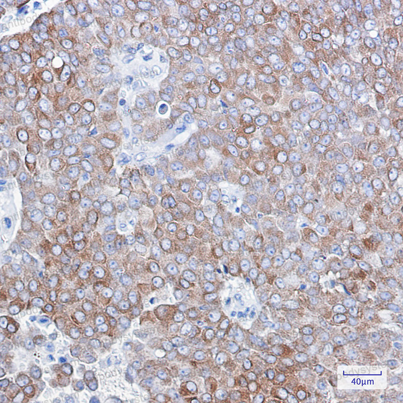Anti-BCL2 Antibody (R1M66)