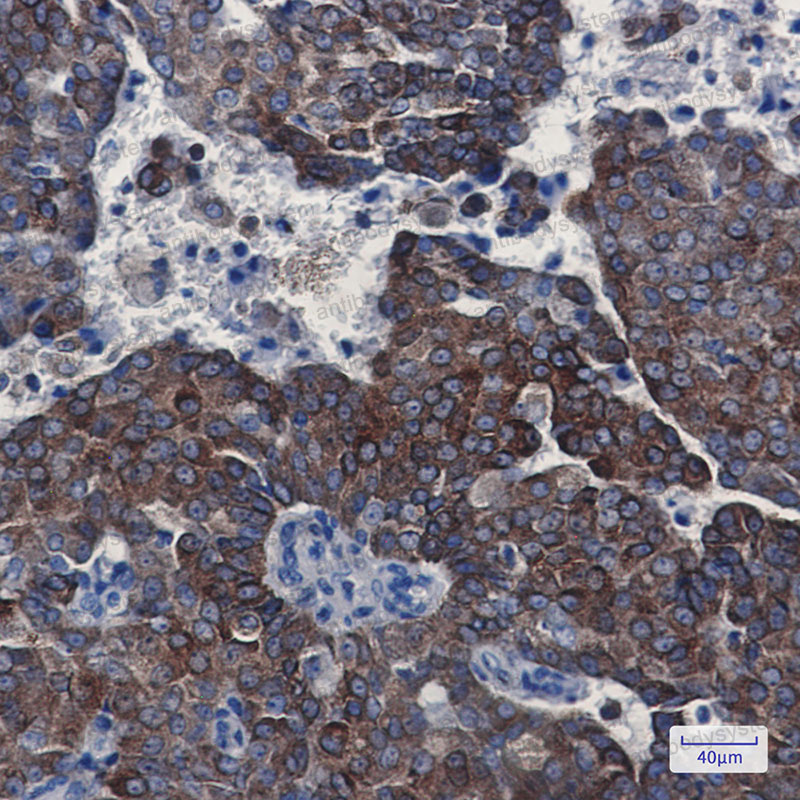 Anti-BCL2 Antibody (R1M65)