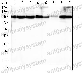 Western blot for Anti-BCL2 Antibody (R3C09) ?>