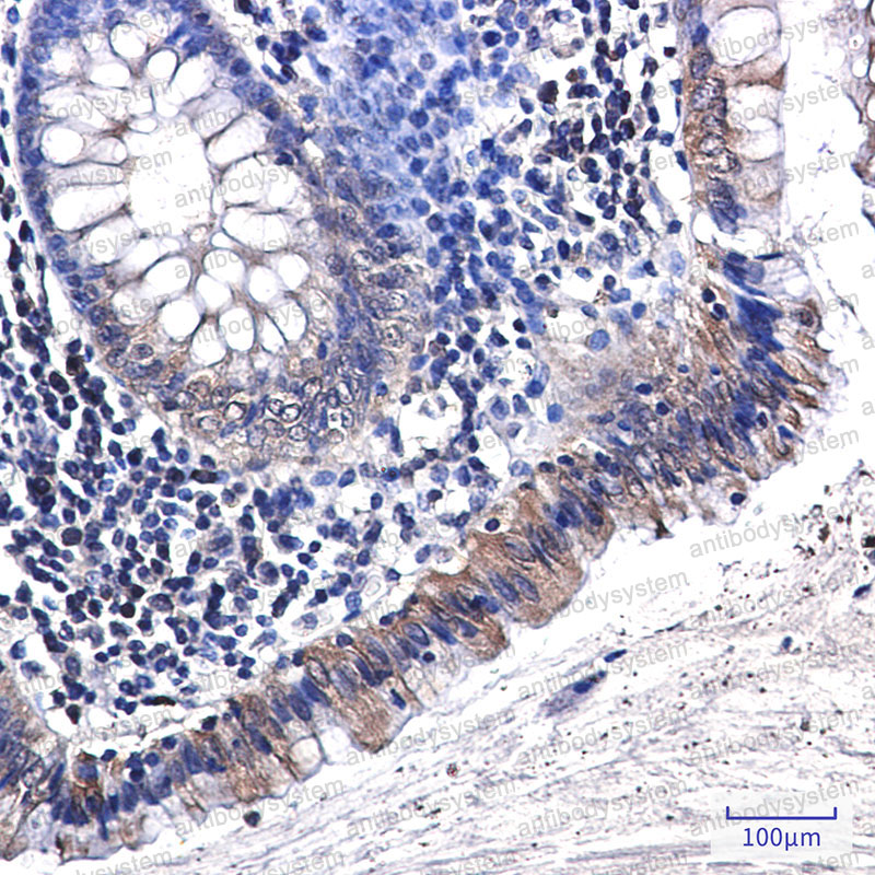 Anti-OPN/Spp1 Antibody (R1M67)