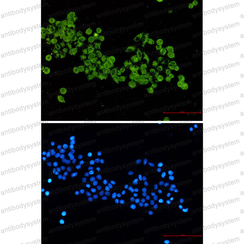 Anti-DLAT/PDC-E2 Antibody (R1M69)