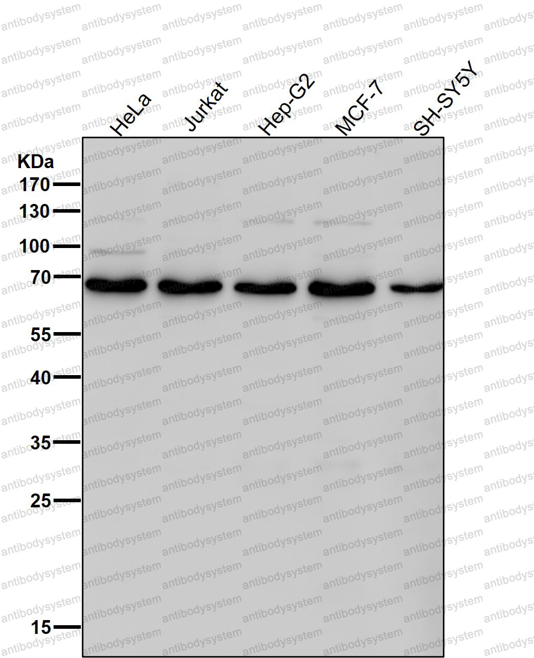 Anti-DLAT/PDC-E2 Antibody (R1M68)