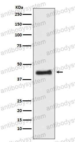 Anti-NR2F1 Antibody (R1M70)