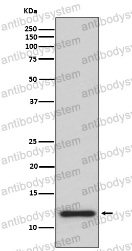 Anti-TXN Antibody (R1M71)