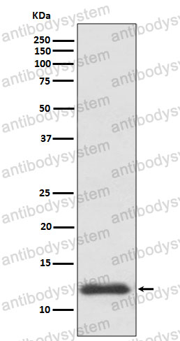 Anti-TXN Antibody (R1M72)