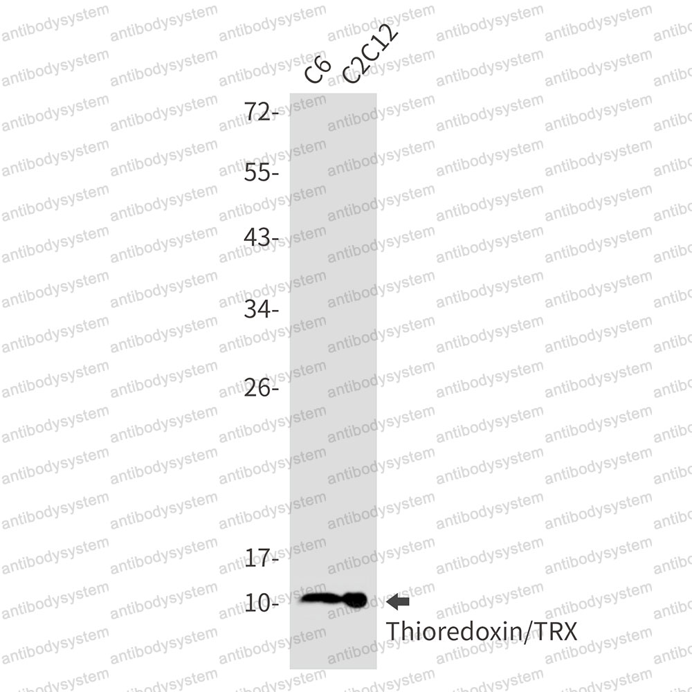 Anti-TXN Antibody (R1M74)