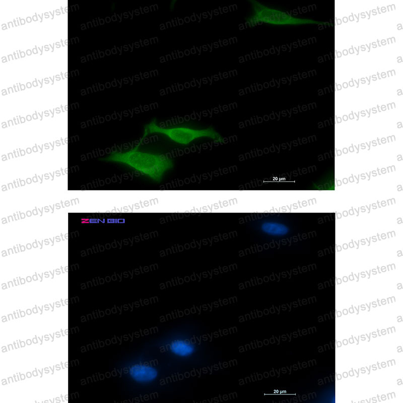 Anti-COX5B Antibody (R1M75)