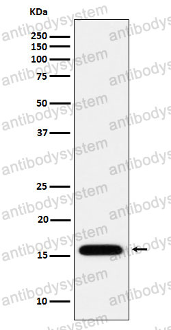 Anti-MGST1 Antibody (R1M76)