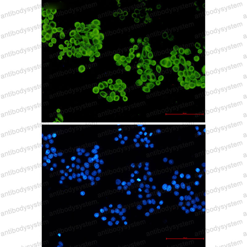 Anti-CYP2D6 Antibody (R1M79)