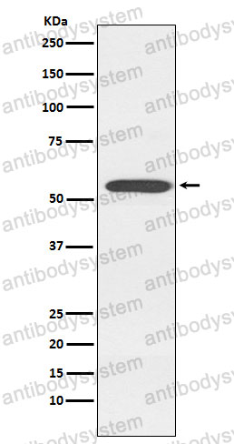 Anti-CYP2D6 Antibody (R1M78)