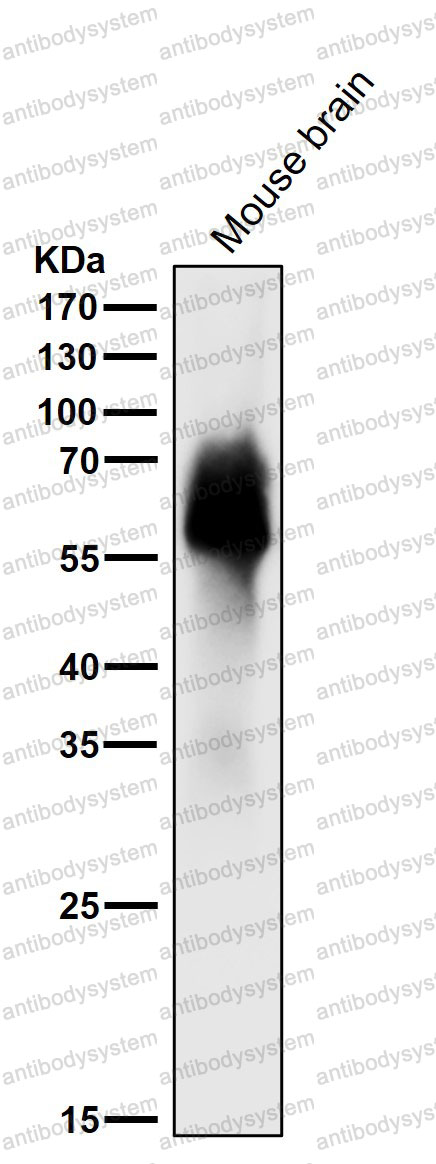 Anti-MAPT/Tau/PHF-tau Antibody (R1A19)