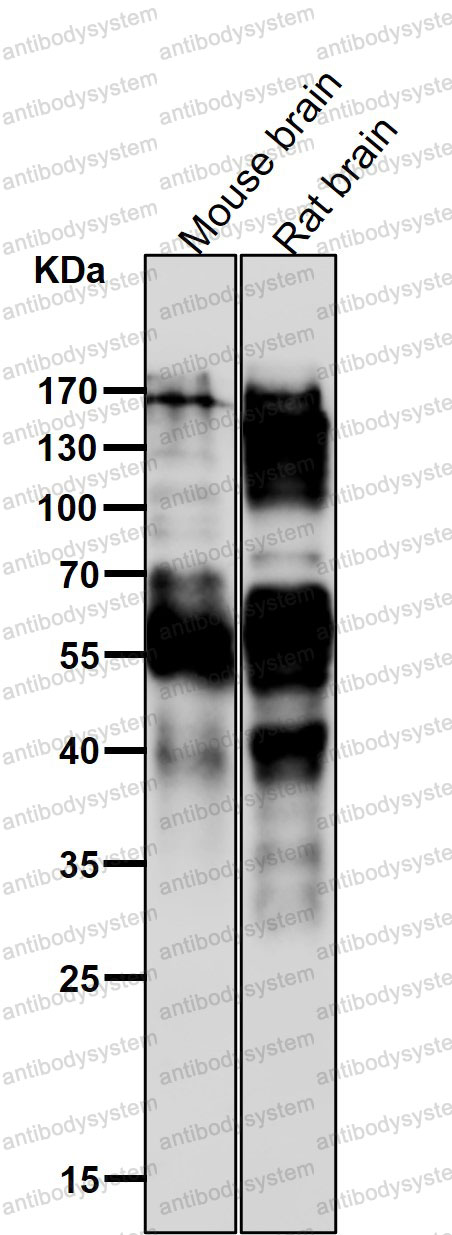 Anti-Phospho-Tau (T231) Antibody (R1M80)