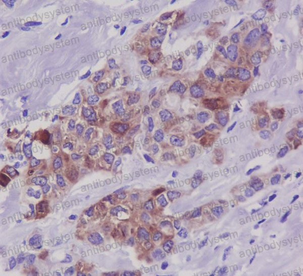 Anti-Phospho-Tau (S396) Antibody (R1M81)