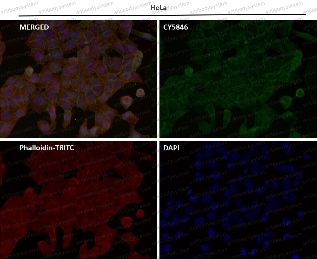Anti-MAPT/Tau/PHF-tau Antibody (R1M82)