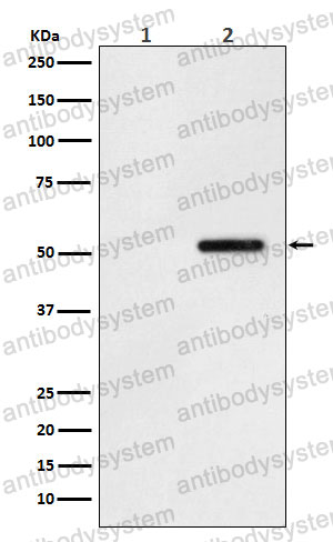 Anti-Phospho-Tau (S324) Antibody (R1M83)