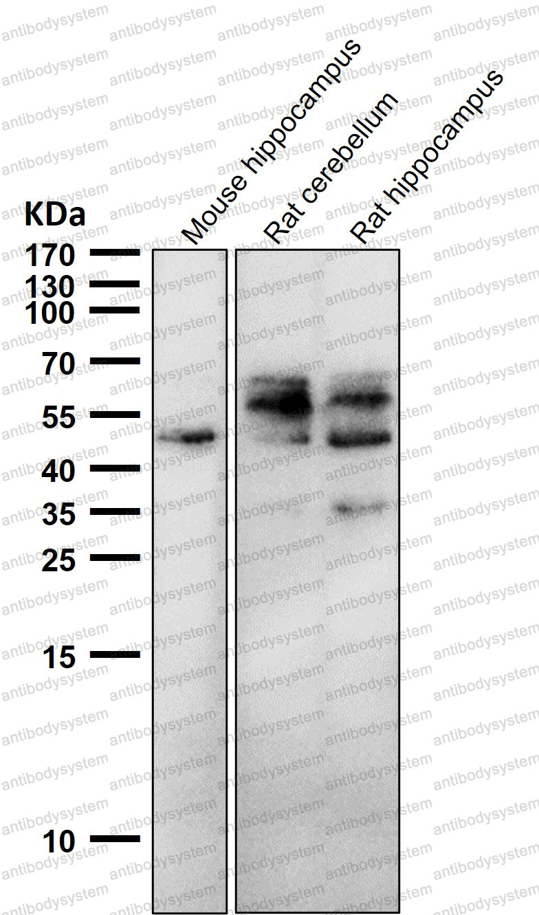 Anti-Phospho-Tau (S198) Antibody (R1M84)
