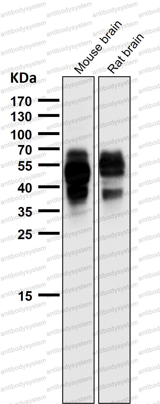 Anti-Phospho-Tau (S202) Antibody (R1M86)