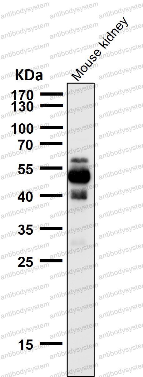 Anti-Phospho-Tau (S404) Antibody (R1M87)