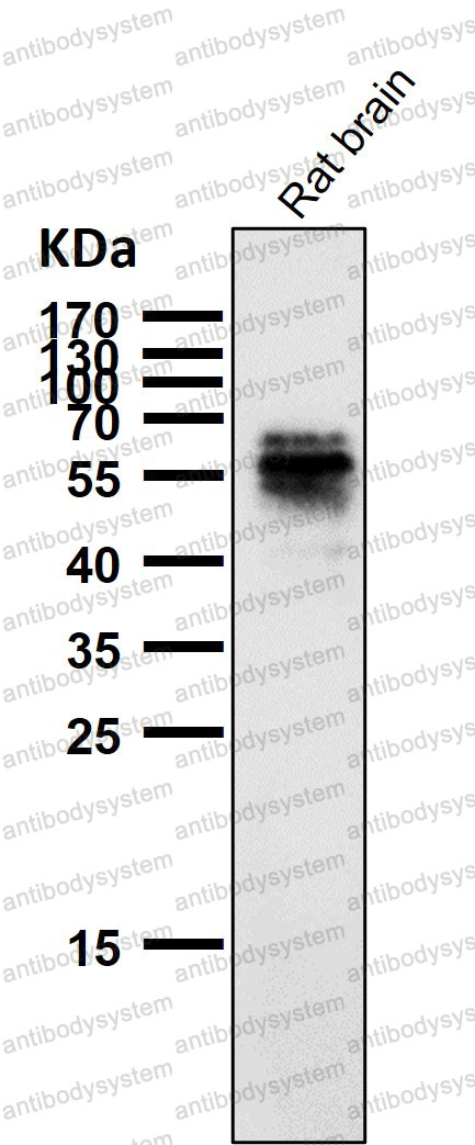 Anti-Phospho-Tau (S214) Antibody (R1M88)