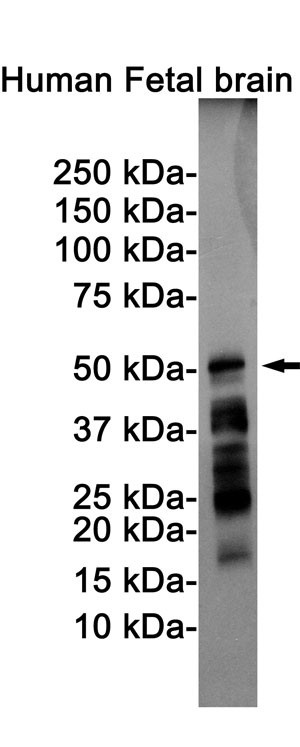 Anti-Phospho-Tau (Ser198) Antibody (R1M90)