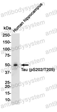 Anti-Phospho-Tau (Ser202/Thr205) Antibody (R1M91)