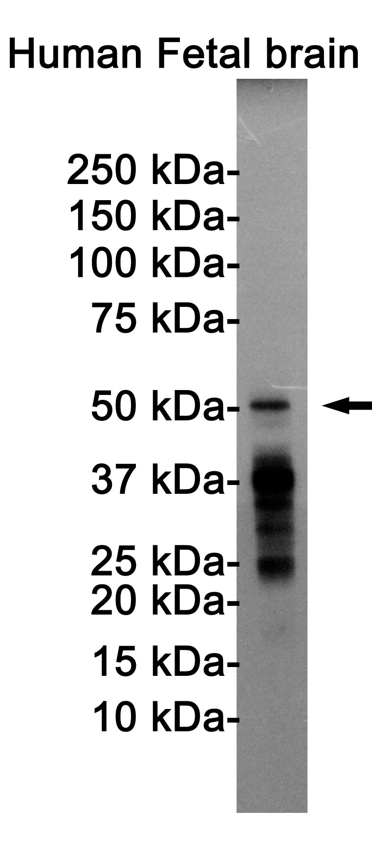 Anti-Phospho-Tau (Thr205) Antibody (R1M92)
