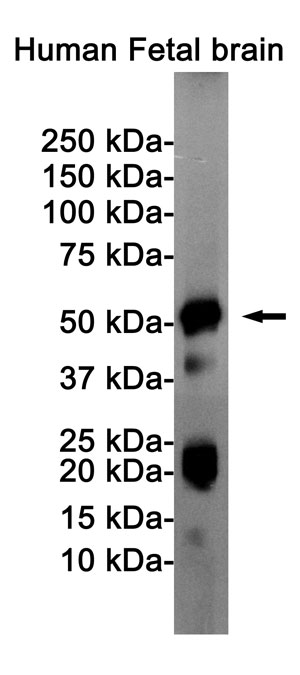 Anti-Phospho-Tau (Ser404) Antibody (R1M93)