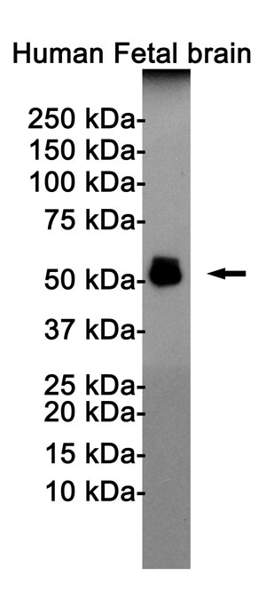 Anti-Phospho-Tau (Thr181) Antibody (R1M94)