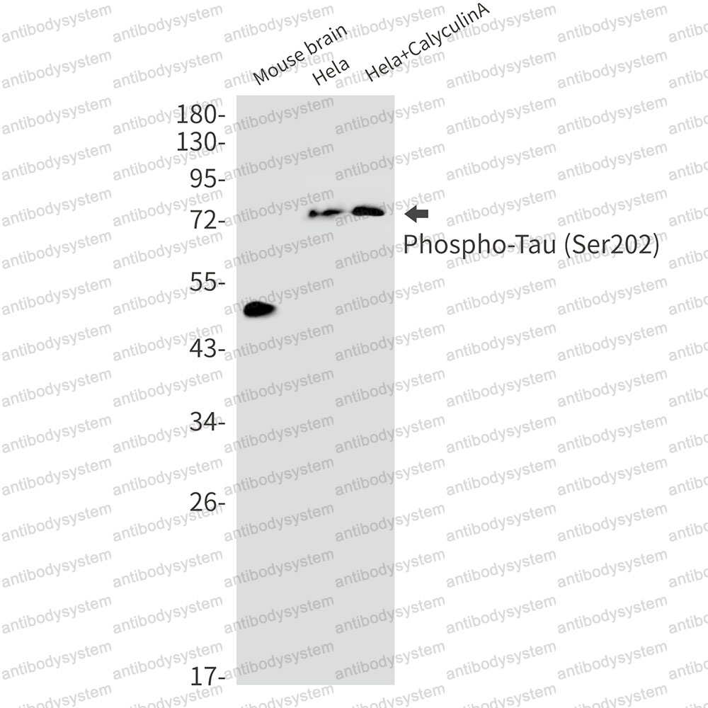 Anti-Phospho-Tau (Ser202) Antibody (R1M95)