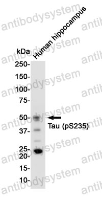 Anti-Phospho-Tau (Ser235) Antibody (R1M96)