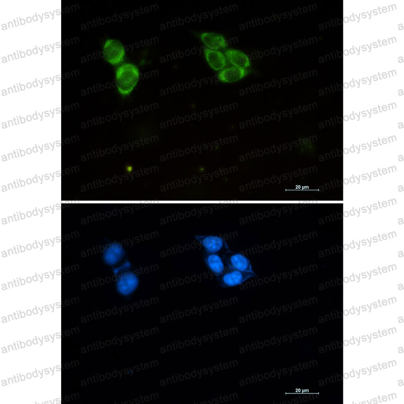 Anti-Phospho-Tau (Thr50) Antibody (R1M97)