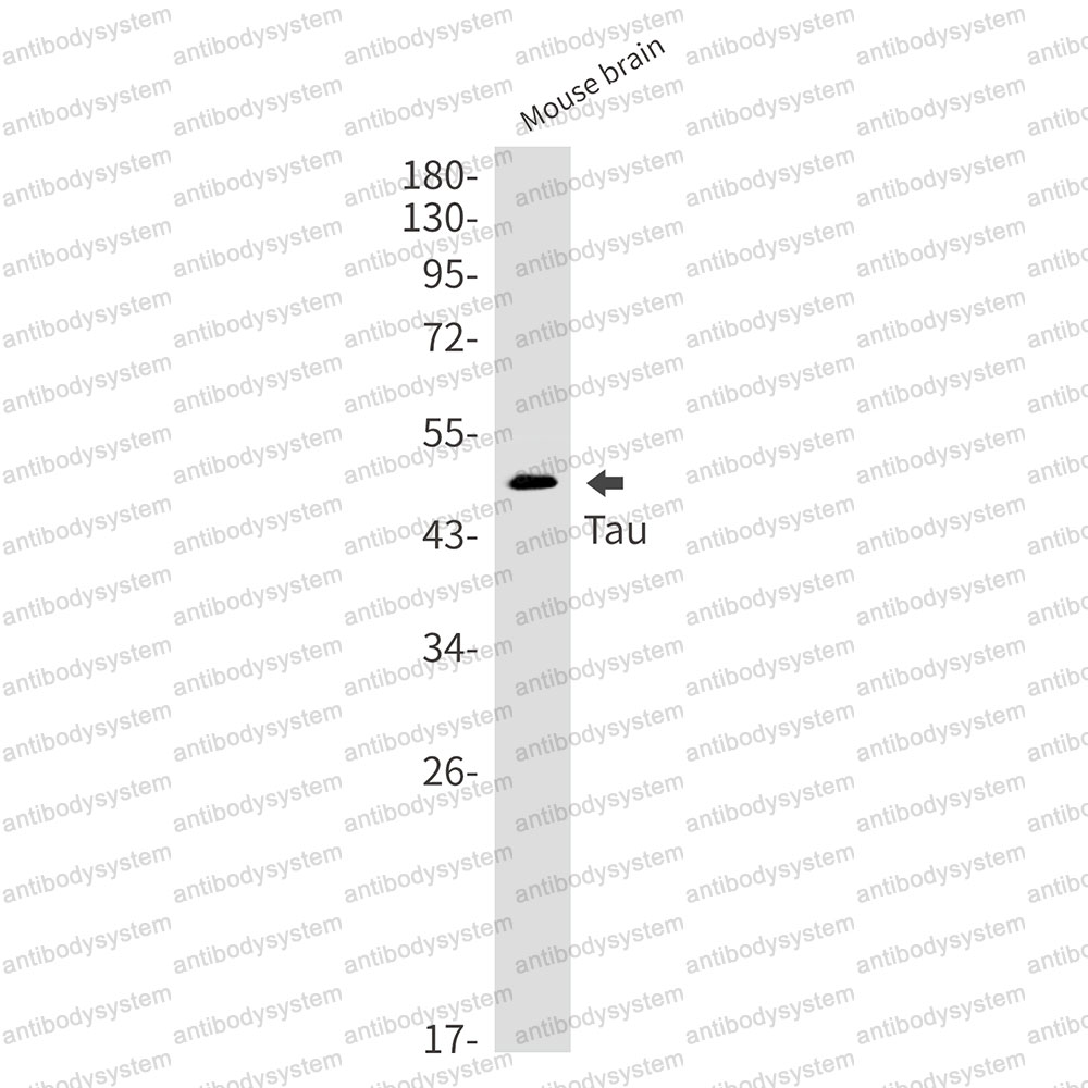 Anti-MAPT/Tau/PHF-tau Antibody (R1M99)