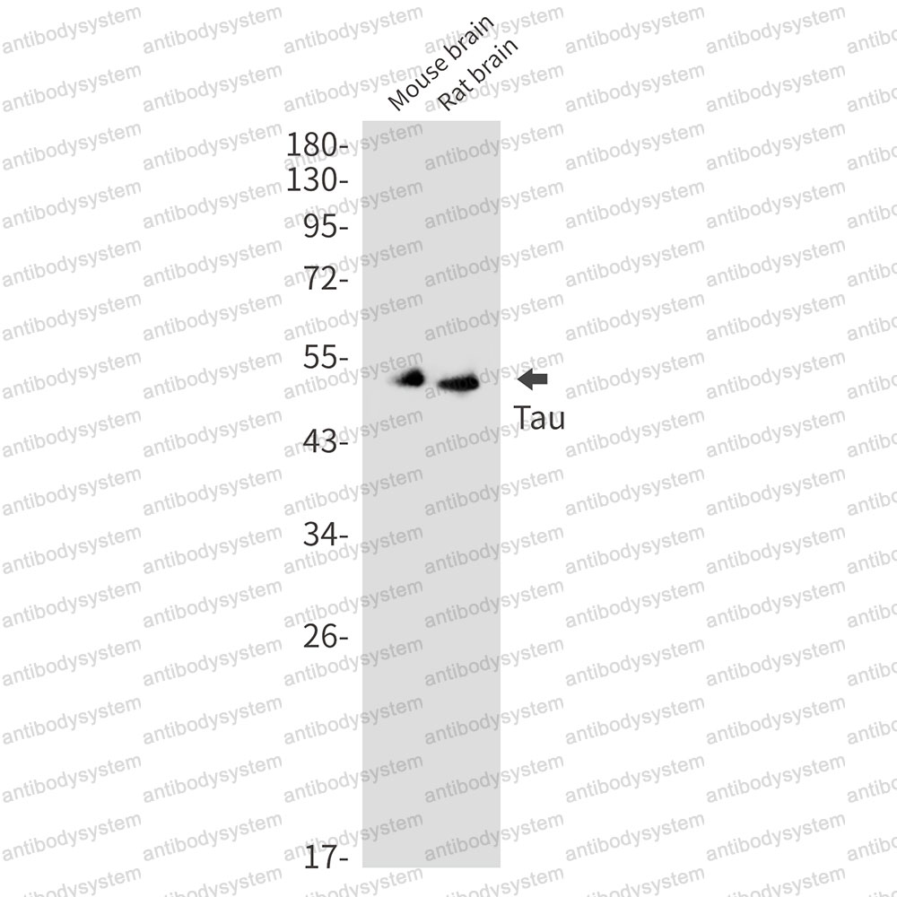 Anti-MAPT/Tau/PHF-tau Antibody (R1M98)