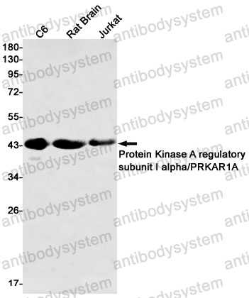 Anti-PRKAR1A Antibody (R1N02)