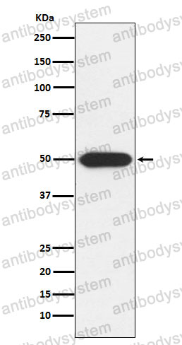 Anti-PRKAR1A Antibody (R1N01)