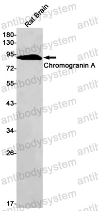 Anti-CHGA Antibody (R1N03)