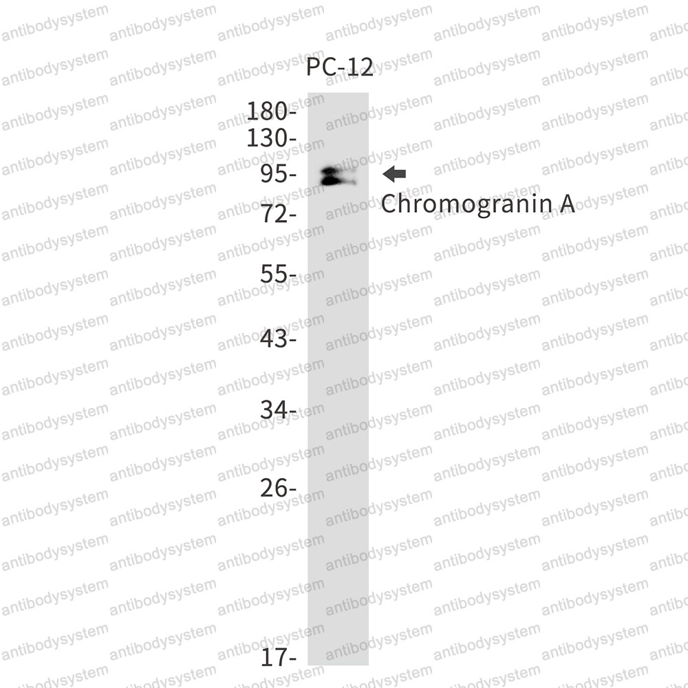 Anti-CHGA Antibody (R1N04)