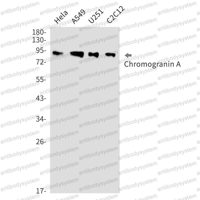 Anti-CHGA Antibody (R1N05)