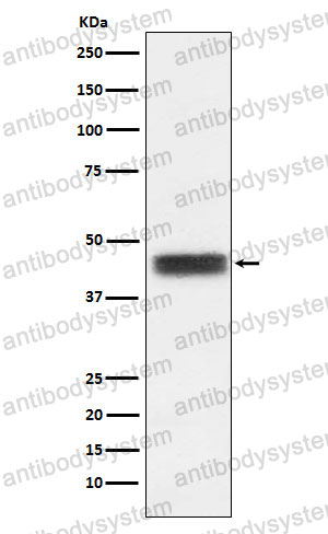 Anti-TFPI Antibody (R1N06)