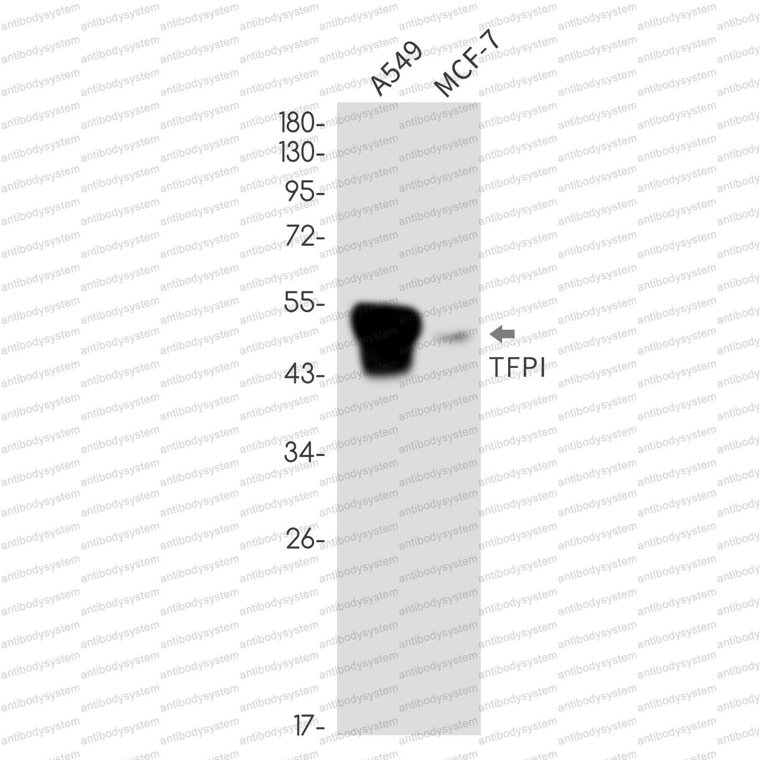 Anti-TFPI Antibody (R1N08)