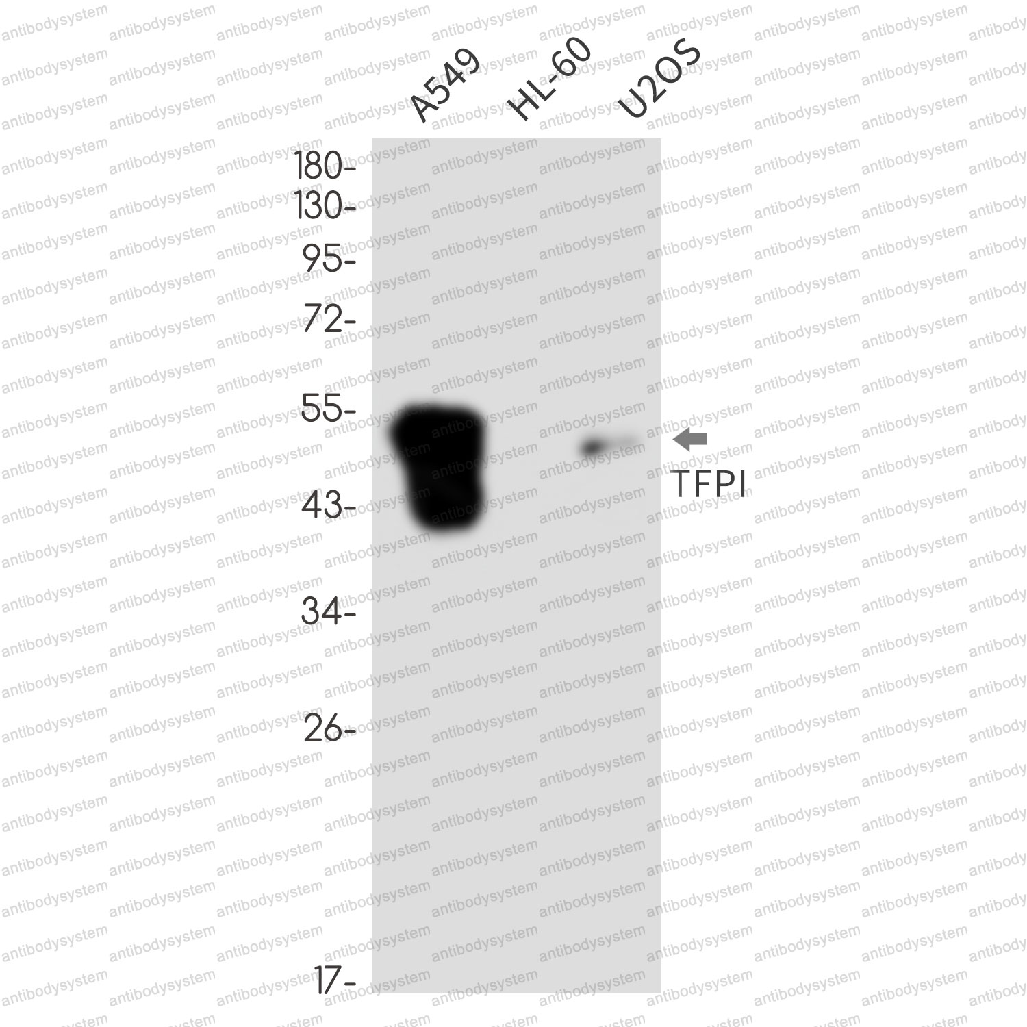 Anti-TFPI Antibody (R1N07)