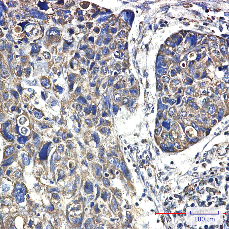 Anti-HSPD1 Antibody (R1N09)