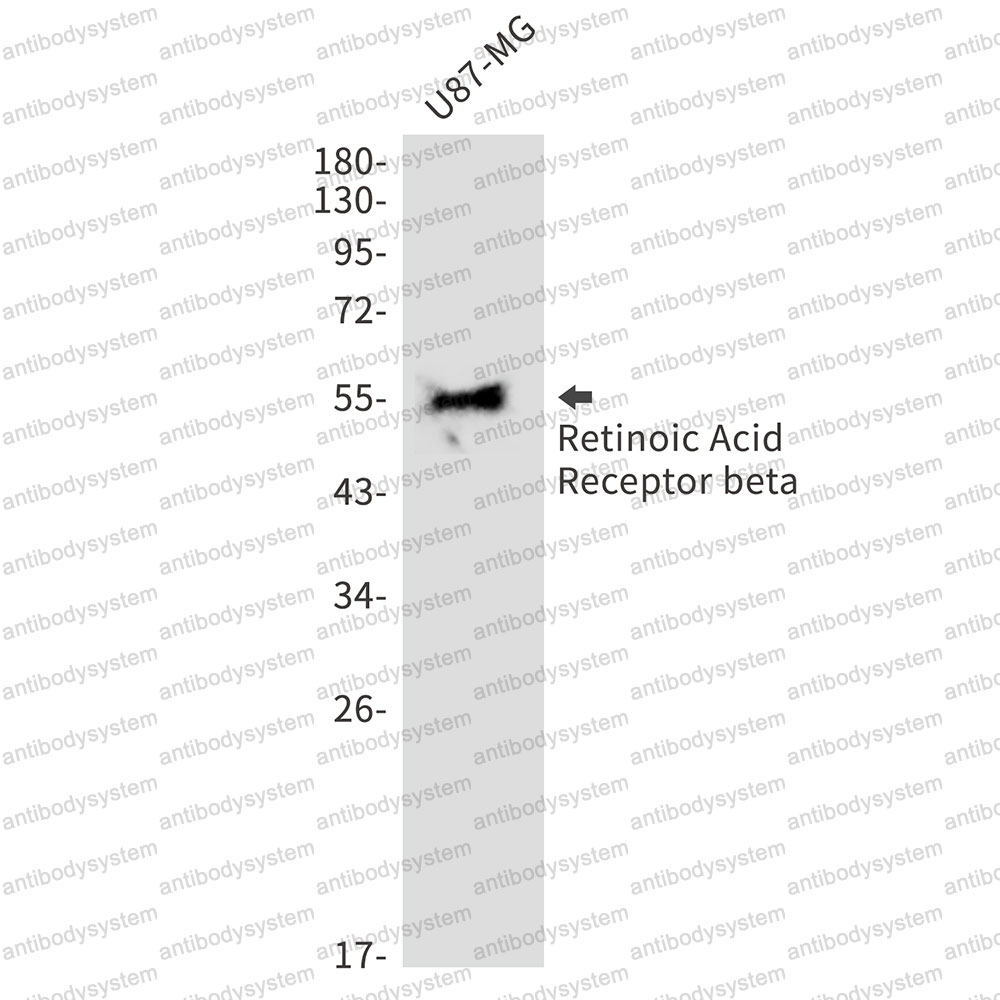 Anti-RARB Antibody (R1N12)