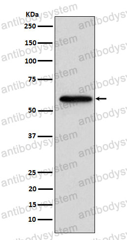Anti-RARB Antibody (R1N11)