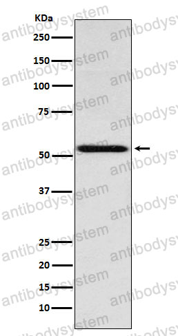Anti-THRA Antibody (R1N13)