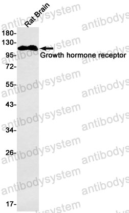 Anti-GHR Antibody (R1N18)